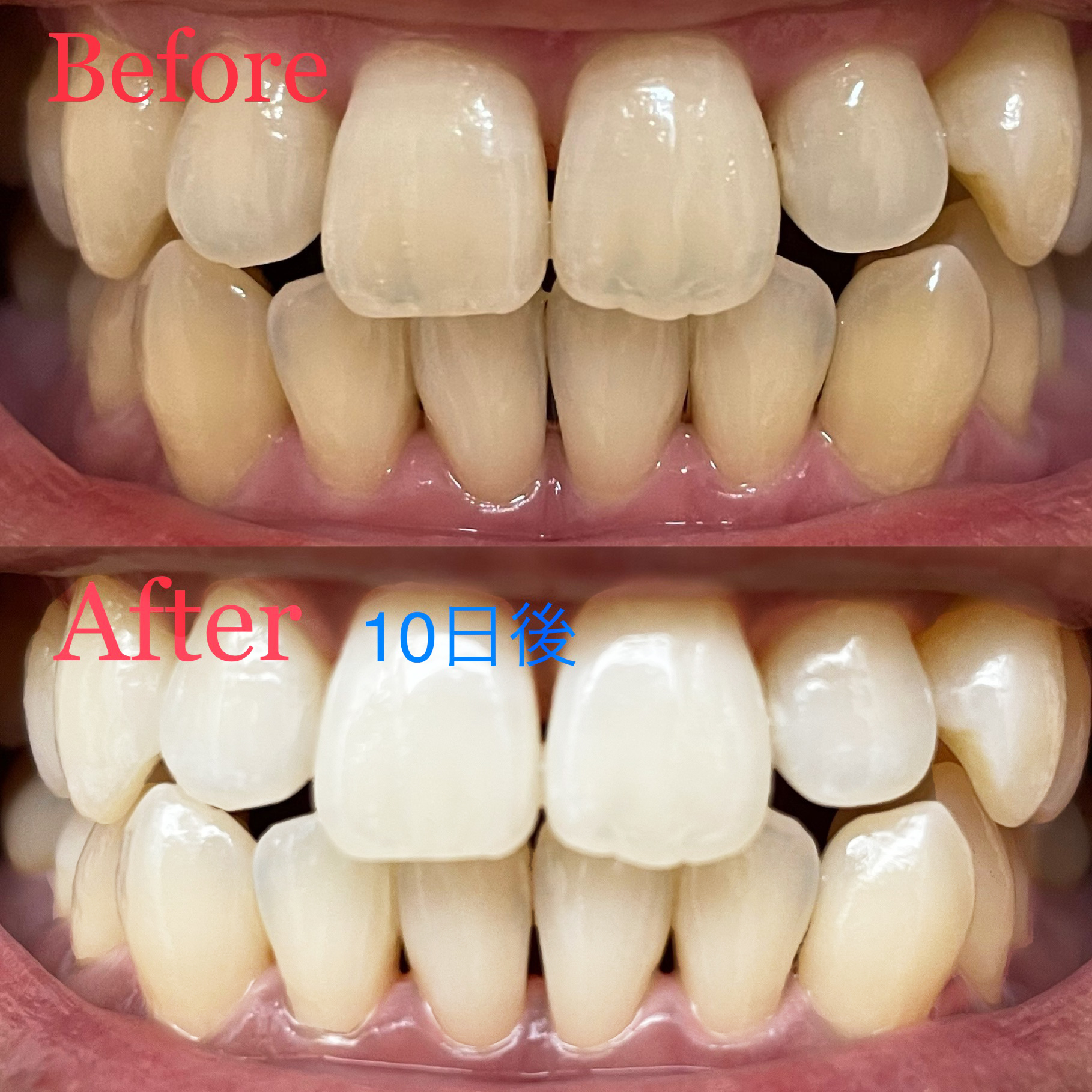 多治見市・宮前カトウ歯科医院
